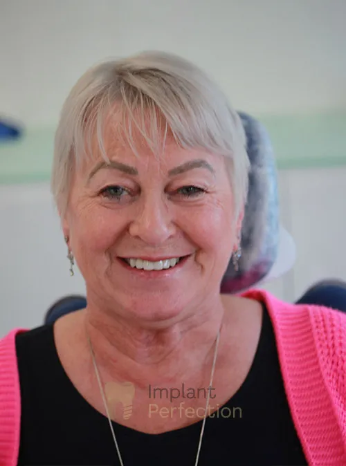Dental implant patient after treatment