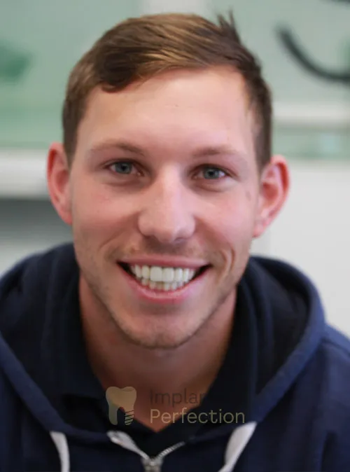 Dental implant patient after treatment