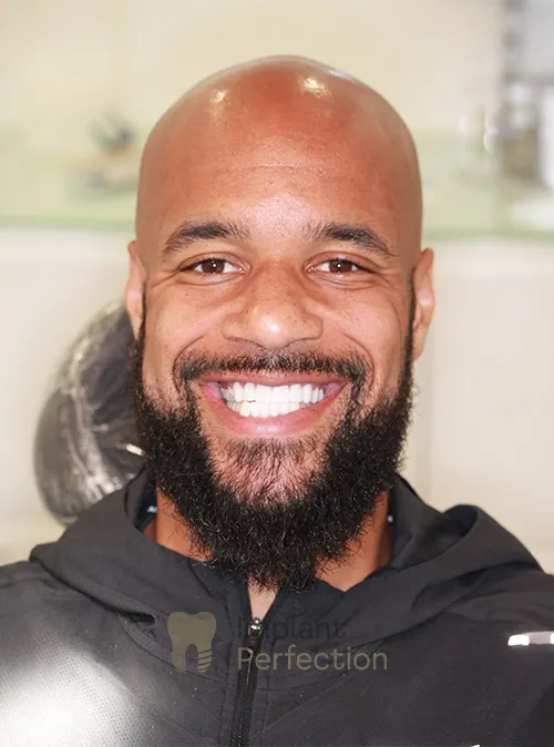 Dental implant patient after treatment