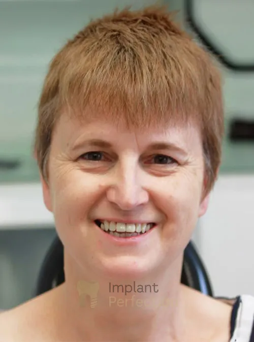 Dental implant patient after treatment